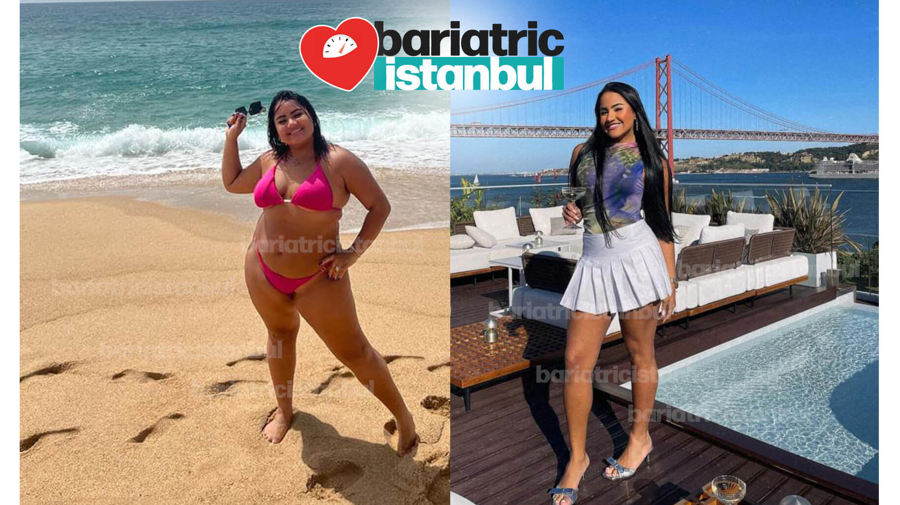 Fotos antes y después