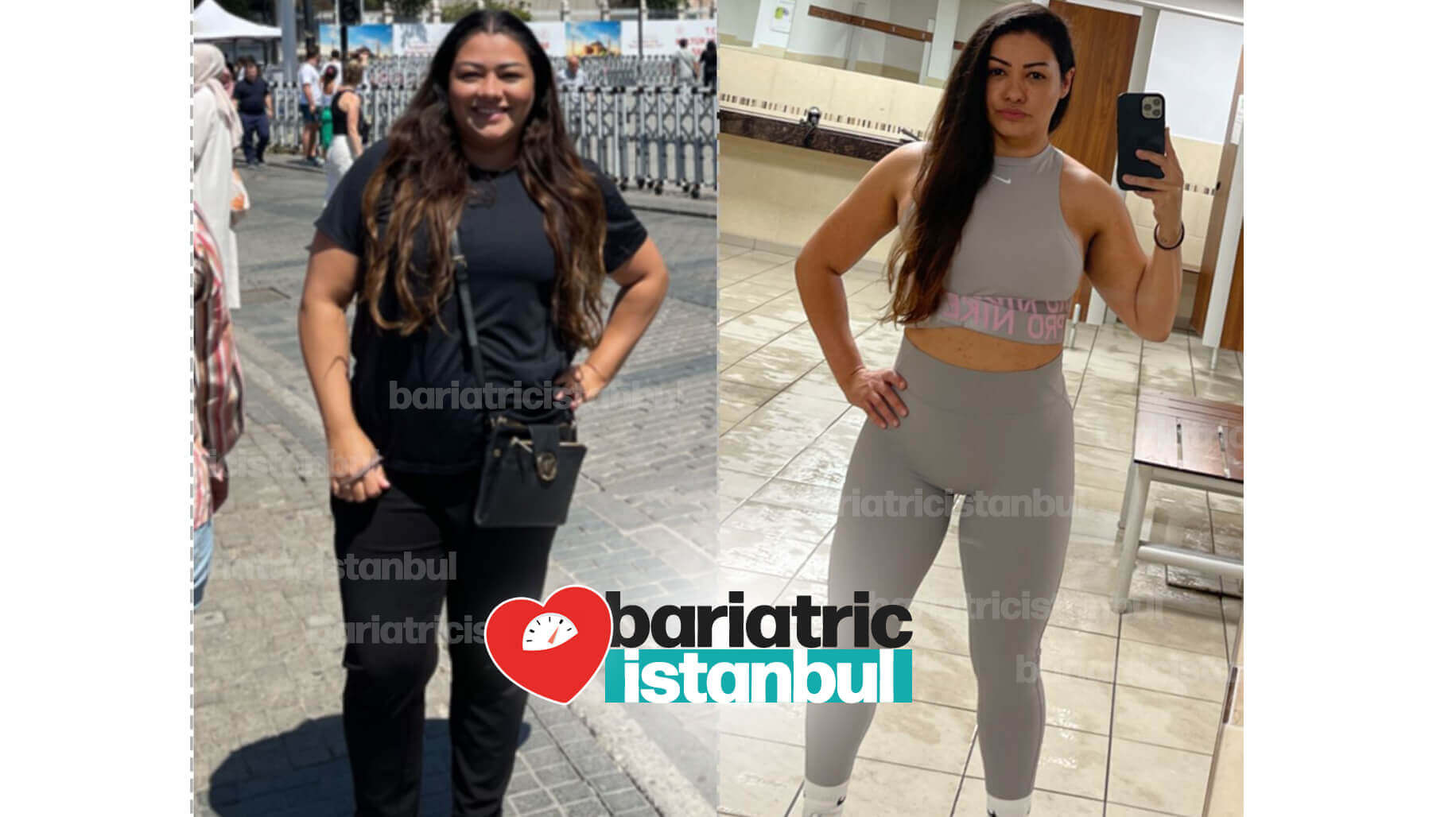 Fotos antes y después